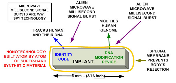 HOW AN ALIEN IMPLANT MAY WORK